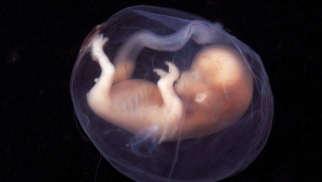 fetus-jpg-653x0_q80_crop-smart-1